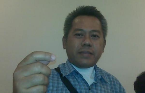 Curhat Pria yang Lehernya Bolong karena Asap Rokok